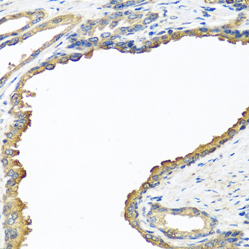 Immunohistochemistry of paraffin-embedded human prostate using NYX antibody  at dilution of 1:100 