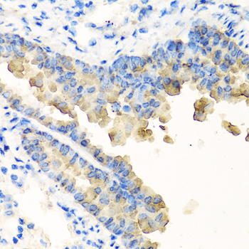 Immunohistochemistry of paraffin-embedded mouse lung using NYX antibody  at dilution of 1:100 