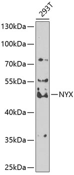 Western blot analysis of extracts of 293T cells, using NYX antibody  at 1:1000 dilution