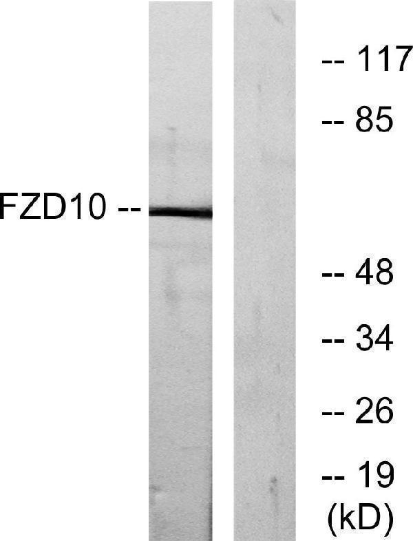Western blot analysis of lysates from COS7 cells, using FZD10 Antibody