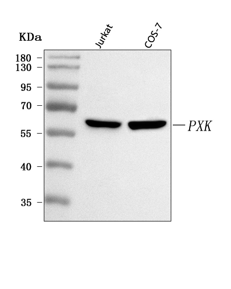  Western blot analysis of PXK using anti-PXK antibody (A07555-1)