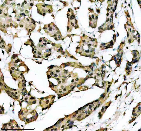 IHC analysis of DPF2 using anti-DPF2 antibody (A07556-3)
