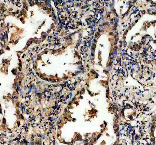 IHC analysis of DPF2 using anti-DPF2 antibody (A07556-3)