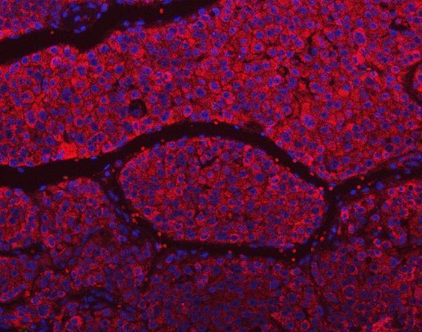 a07557 2 slu7 primary antibodies if testing 6
