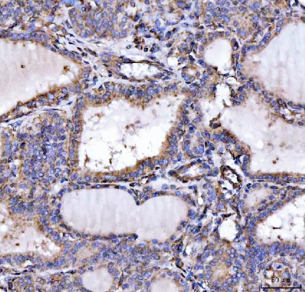  IHC analysis of SLU7 using anti-SLU7 antibody (A07557-2)