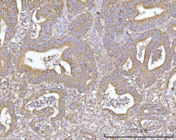  IHC analysis of SLU7 using anti-SLU7 antibody (A07557-2)