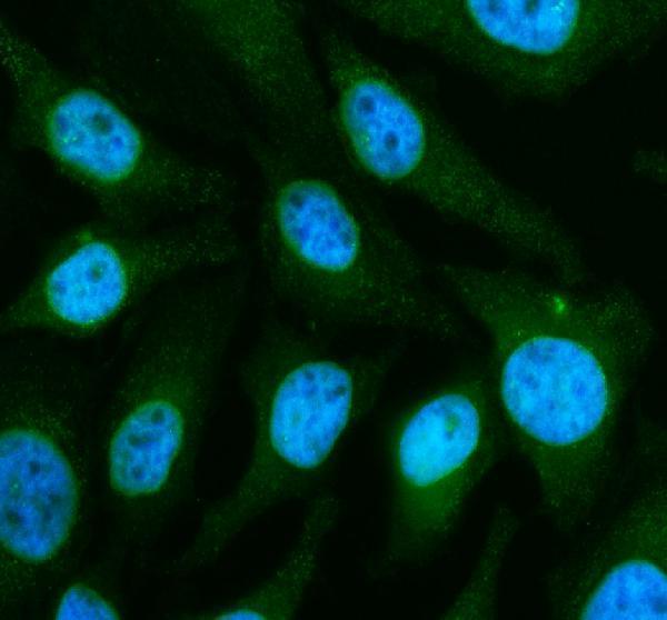 a07559 4 acaa1 primary antibodies if testing 1