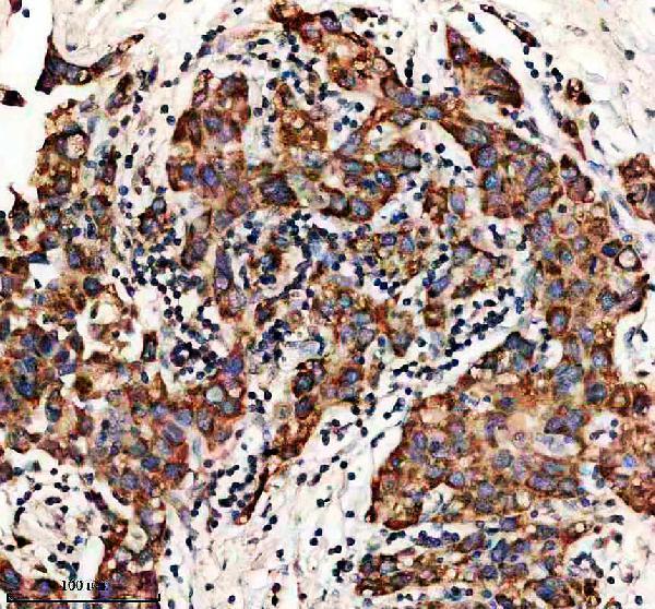 a07559 4 acaa1 primary antibodies ihc testing 1