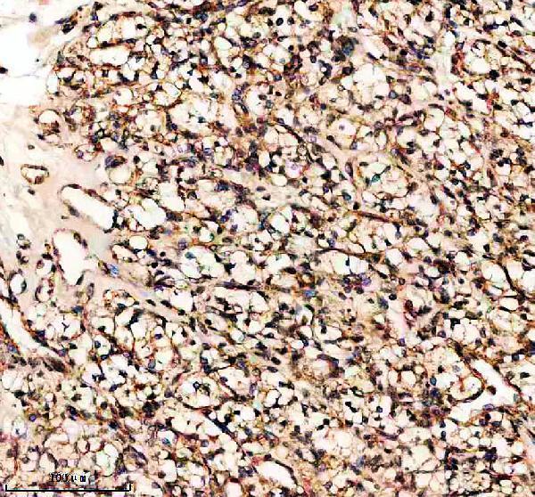 a07559 4 acaa1 primary antibodies ihc testing 2