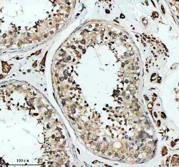 IHC analysis of SKA3 using anti-SKA3 antibody (A07561-1)