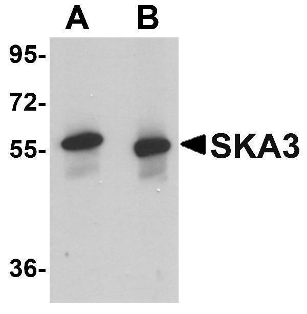 a07561 ska3 primary antibodies wb testing 1