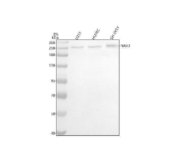 Western blot analysis of NAV3 using anti-NAV3 antibody (A07567-1)