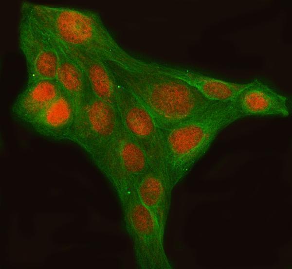 a07568 1 lhx6 primary antibodies if testing 3