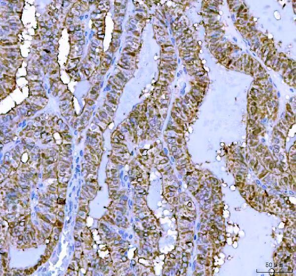 a07568 1 lhx6 primary antibodies ihc testing 2