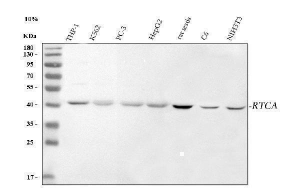  Western blot analysis of RTCA using anti-RTCA antibody (A07570-2)