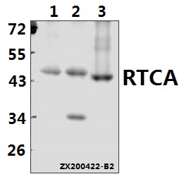 Western blot (WB) analysis of RTCA pAb at 1:500 dilution
Lane1:SGC7901 whole cell lysate(40ug)
Lane2:Panc1 whole cell lysate(40ug)
Lane3:C6 whole cell lysate(40ug)