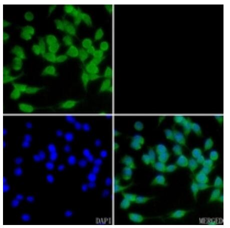 a07572 ccnb3 primary antiboties if testing 2