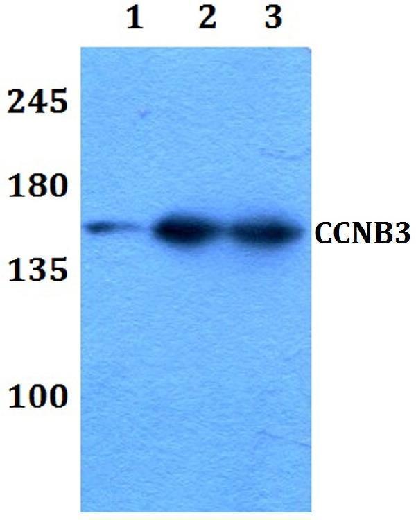 a07572 ccnb3 primary antiboties wb testing 1