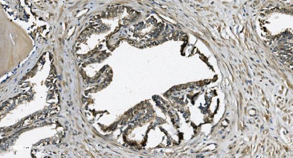 a07576 2 grsf1 primary antibodies ihc testing 5