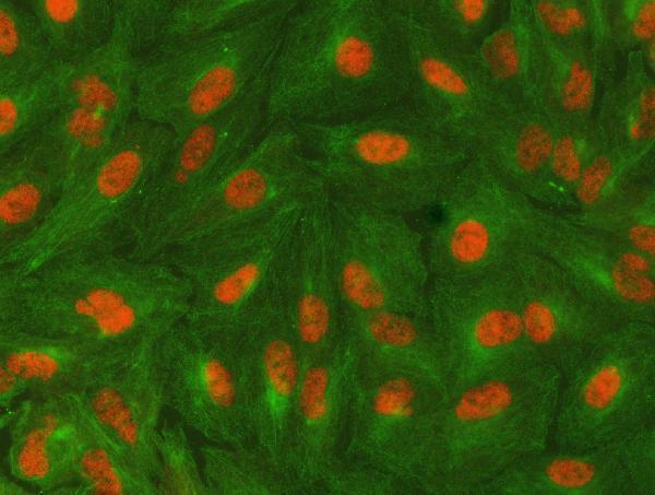 a07578 1 sap130 primary antibodies if testing 10