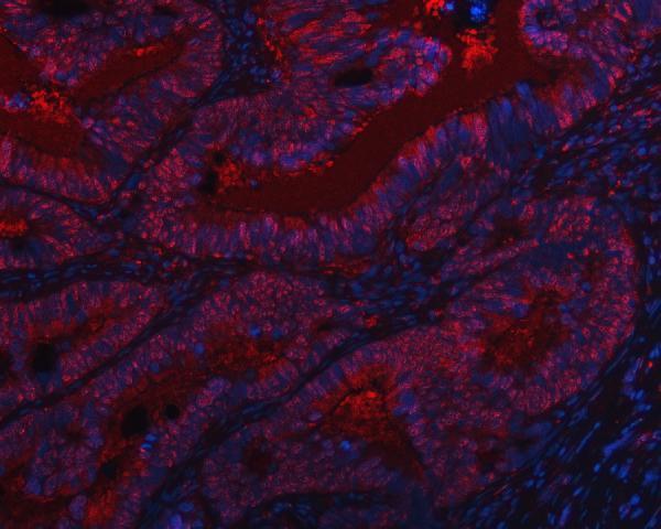 a07578 1 sap130 primary antibodies if testing 11