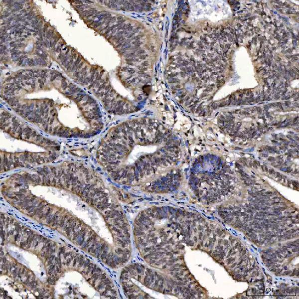  IHC analysis of SAP130 using anti-SAP130 antibody (A07578-1)