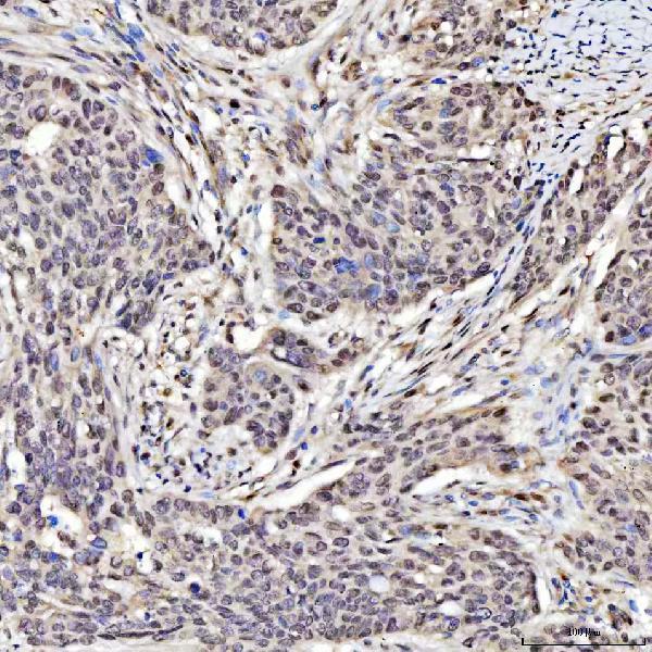  IHC analysis of SAP130 using anti-SAP130 antibody (A07578-1)