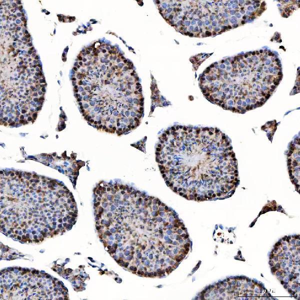 a07578 1 sap130 primary antibodies ihc testing 5