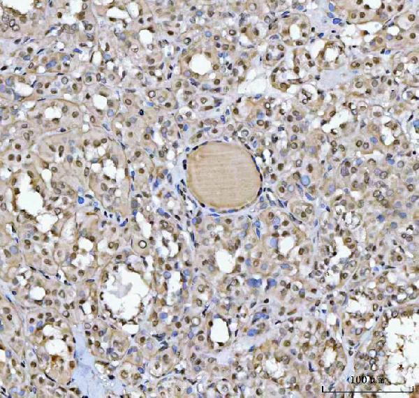 a07578 1 sap130 primary antibodies ihc testing 6