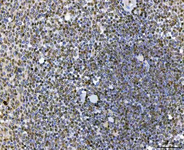 a07578 1 sap130 primary antibodies ihc testing 7