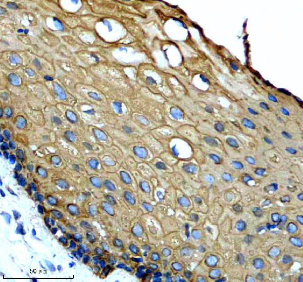 a07579 1 krt6b primary antibodies ihc testing 1