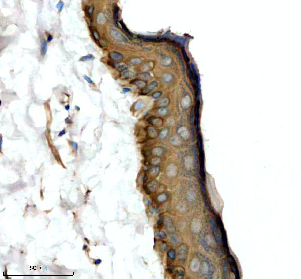 a07579 1 krt6b primary antibodies ihc testing 2