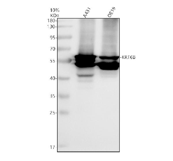 a07579 1 krt6b primary antibodies wb testing 1
