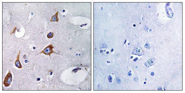 a07580 1 chsy1 primary antibodies ihc testing 1