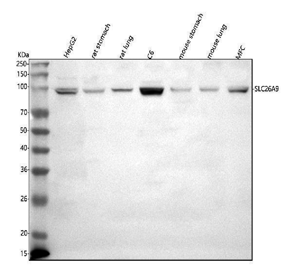  Western blot analysis of SLC26A9 using anti-SLC26A9 antibody (A07581-1)