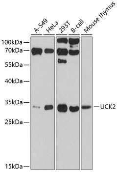 a07582 uck2 primary antiboties wb testing 1