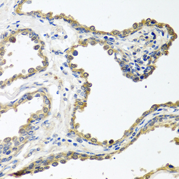 a07583 colec11 primary antiboties ihc testing 2
