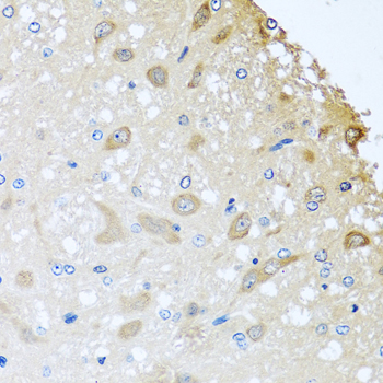 a07583 colec11 primary antiboties ihc testing 3