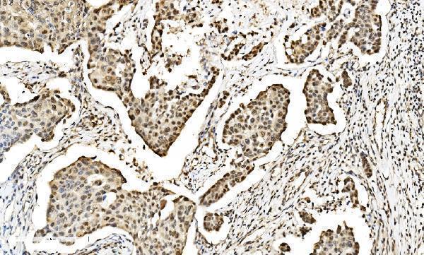  IHC analysis of LSM2 using anti-LSM2 antibody (A07586-2)