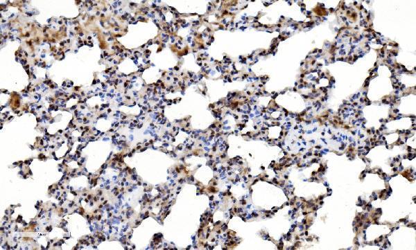 a07586 2 lsm2 primary antibodies ihc testing 11