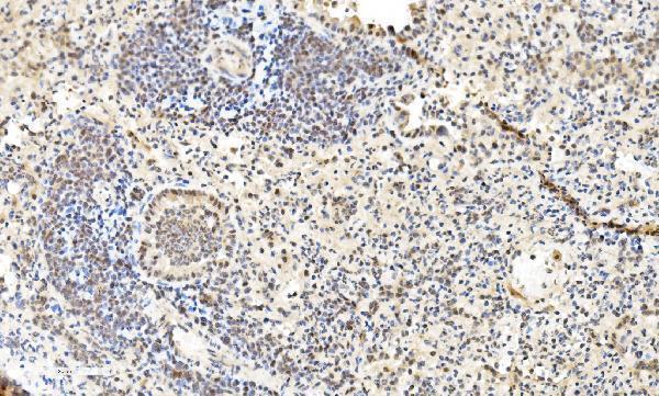 a07586 2 lsm2 primary antibodies ihc testing 12