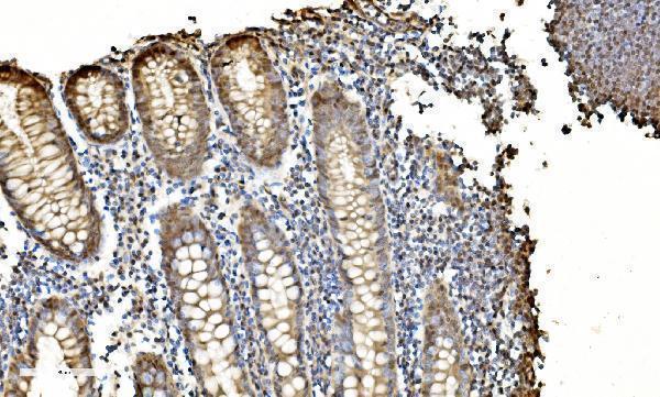 a07586 2 lsm2 primary antibodies ihc testing 6