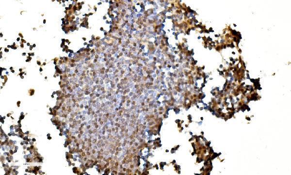 a07586 2 lsm2 primary antibodies ihc testing 7