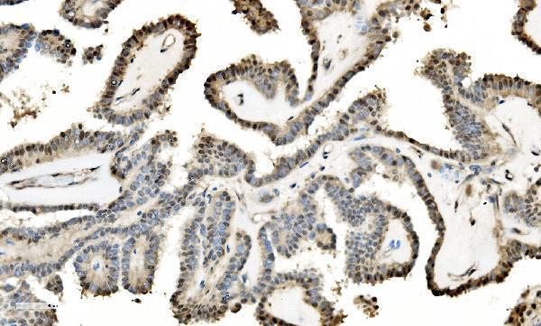 a07586 2 lsm2 primary antibodies ihc testing 8_