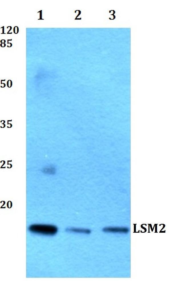a07586 lsm2 primary antiboties wb testing 1