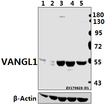 Western blot (WB) analysis of VANGL1 polyclonal antibody at 1:500 dilution
Lane1:PC12 whole cell lysate(40ug)
Lane2:CT26 whole cell lysate(40ug)
Lane3:MCF-7 whole cell lysate(40ug)
Lane4:A549 whole cell lysate(40ug)
Lane5:SK-OVCAR3 whole cell lysate(40ug)