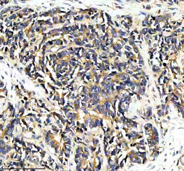 a07588 2 ppp2r5e primary antibodies ihc testing 2