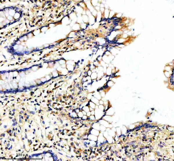 a07588 2 ppp2r5e primary antibodies ihc testing 3