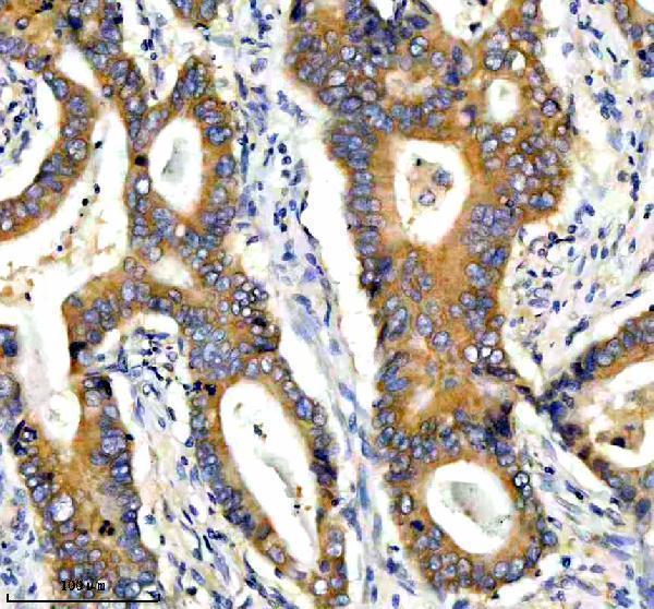 a07588 2 ppp2r5e primary antibodies ihc testing 4