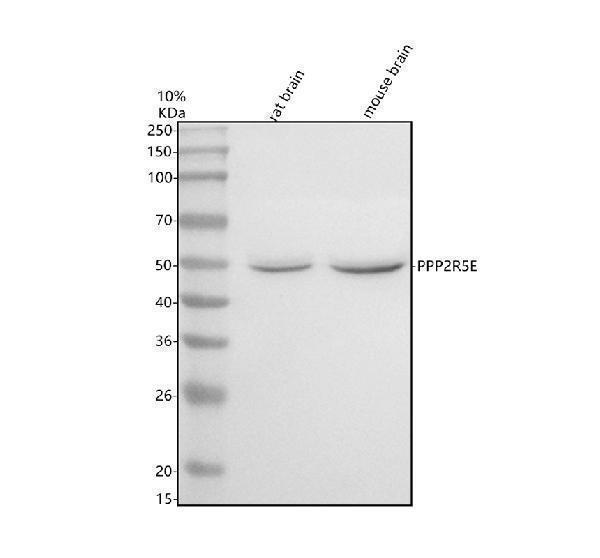 a07588 2 ppp2r5e primary antibodies wb testing 1